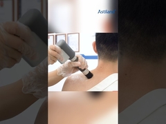 Şok dalgası + titreşim tedavisi makinesi