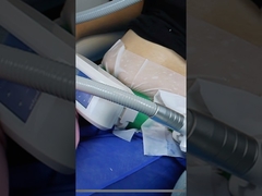 Kilo vermek için yağları dondurmayı denedin mi?