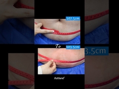 Yağları dondurun, 1 saatte 4 cm kaybetin!