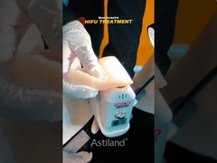 HIFU'nun invaziv olmayan kaldırma gücüne tanık olun.