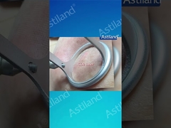 HIFU ile CO2 Lazer, hangi yaşlanmaya karşı tedaviyi tercih edersin?