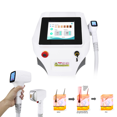 Kalıcı Tüy Alma Nova Buz Diyot Lazer Makinesi 3 Dalga 808nm