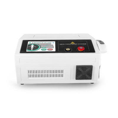 ISO 532nm Pigment Q Anahtarlı ND Yag Lazer Makinesi